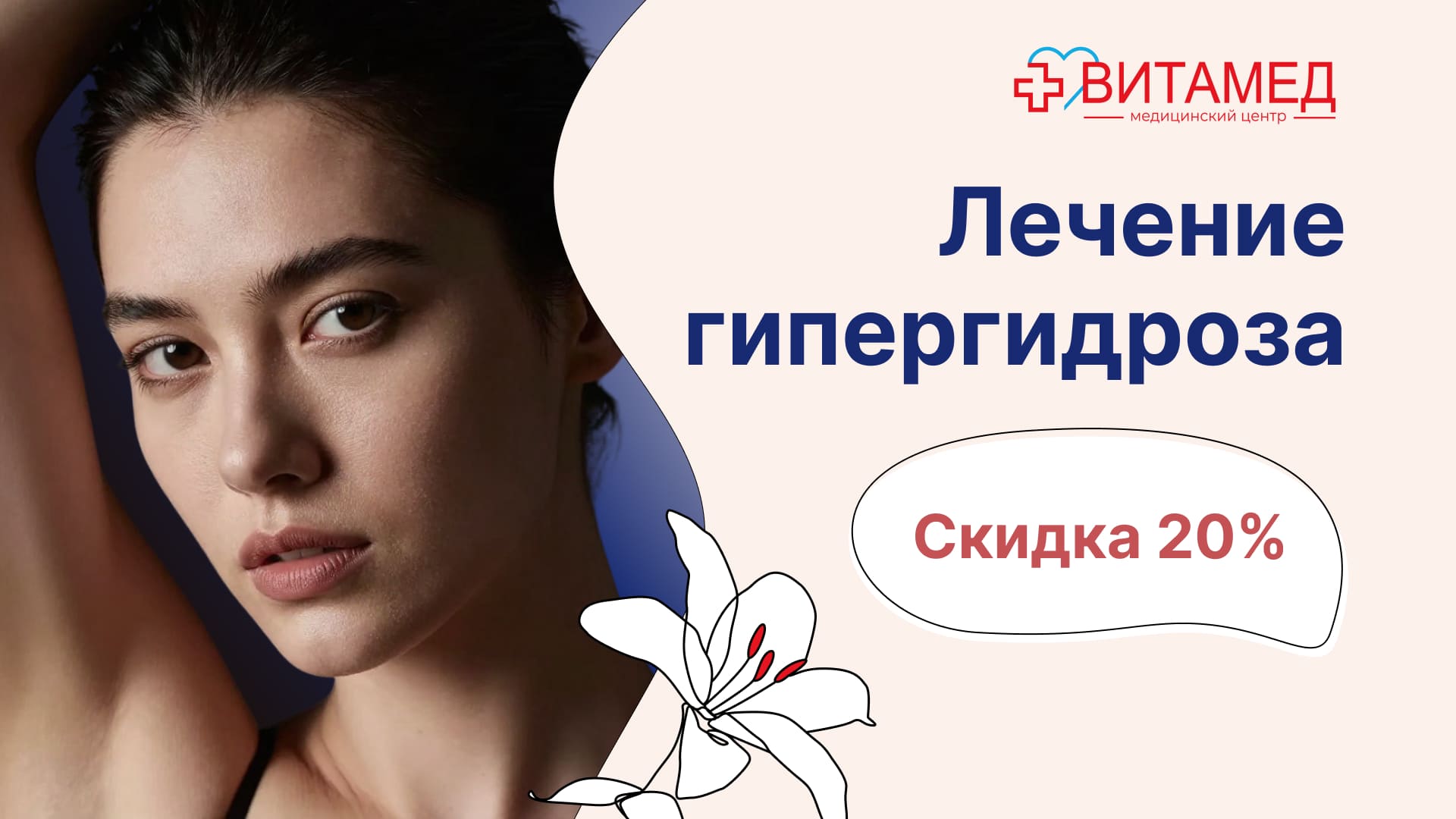 Лечение гипергидроза скидка 20%