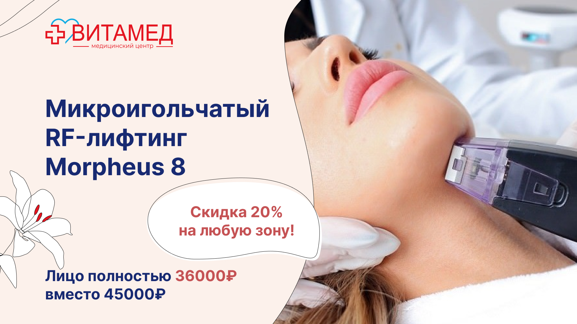 Микроигольчатый RF-лифтинг Morpheus 8  -20% на любую зону!
