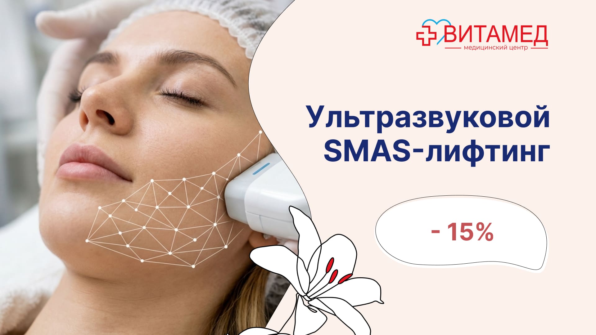 Ультразвуковой SMAS лифтинг -15%