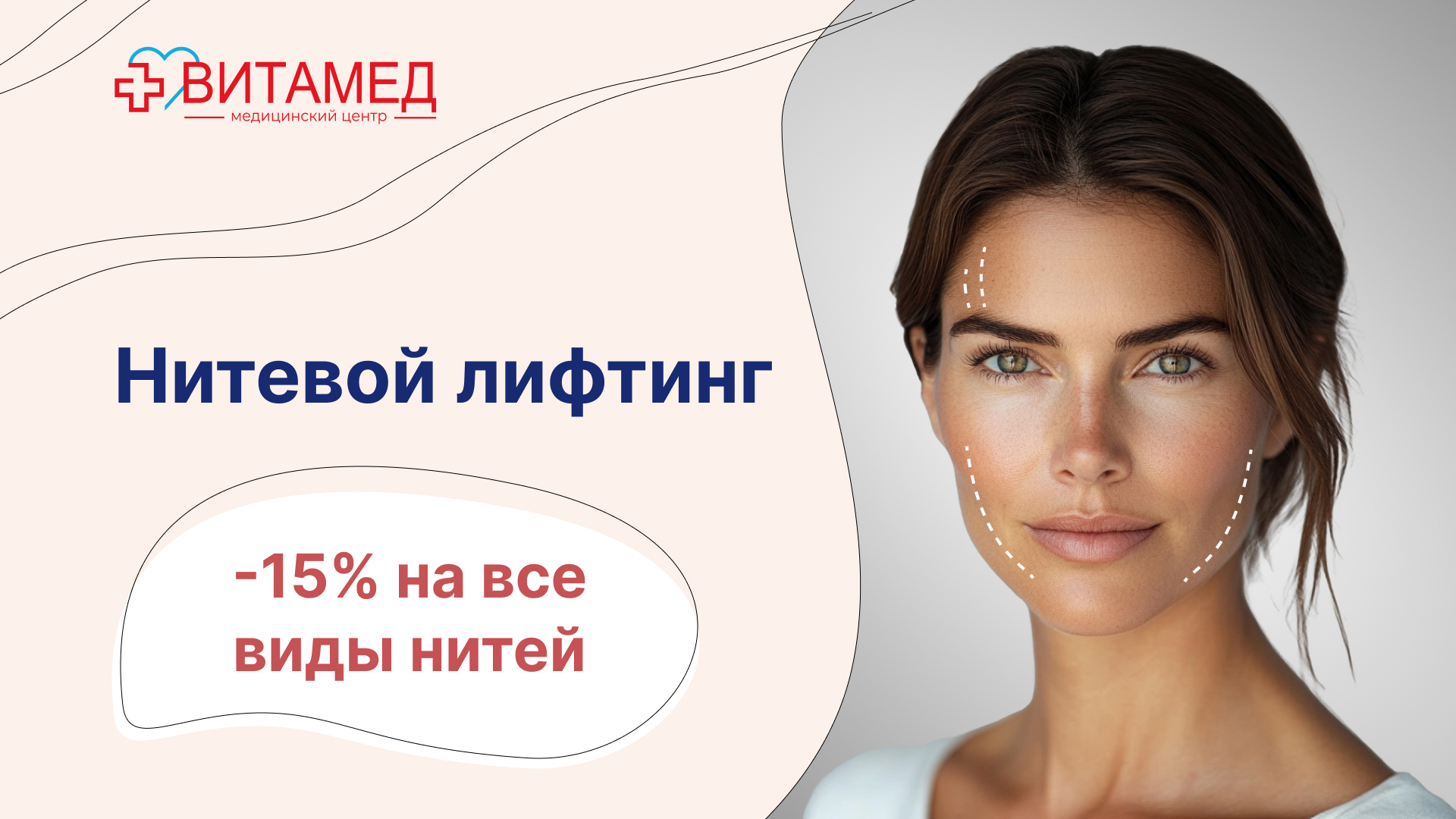 Нитевой лифтинг -15% на все виды нитей!