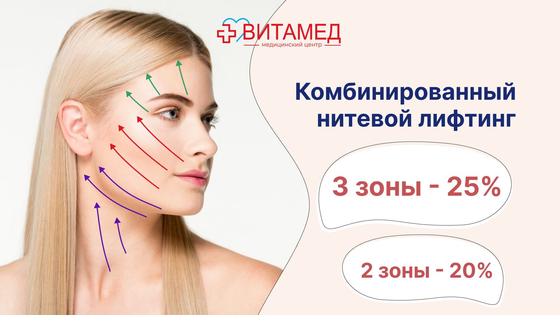 Комбинированный нитевой лифтинг 2 зоны -20%, 3 зоны -25%