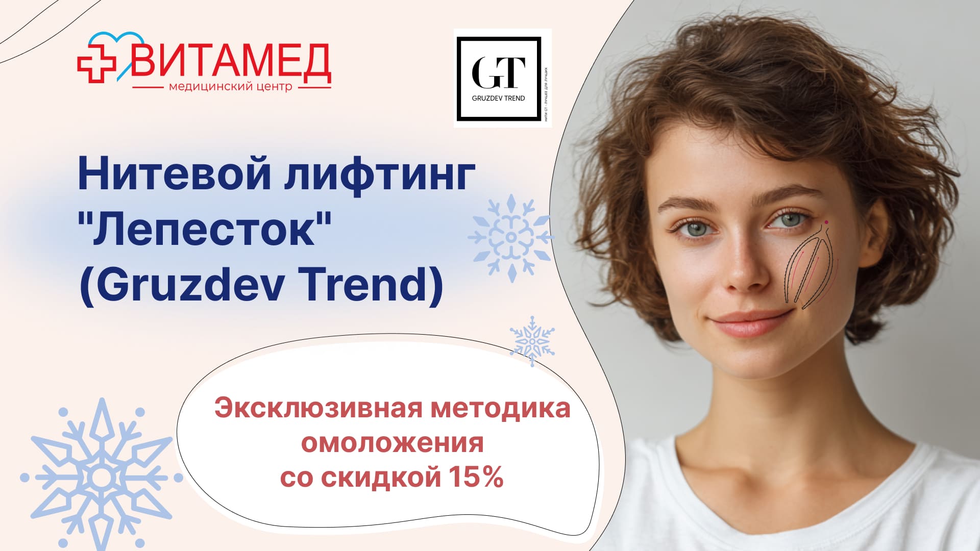  Нитевой лифтинг "Лепесток" (Gruzdev Trend) Эксклюзивная методика омоложения со скидкой 15%